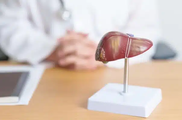 foie-calcul-biliaire